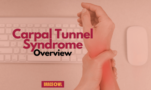 Carpal Tunnel Syndrome – Overview